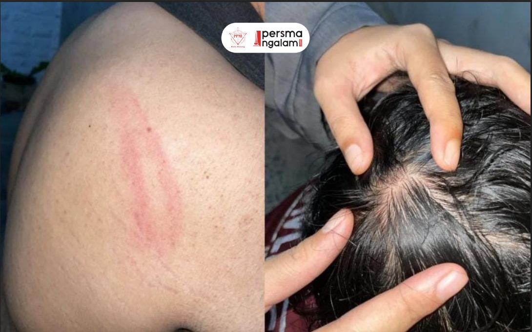 Bentrokan di Malang: Aparat Bubarkan Massa dengan Kekerasan. (Foto: PPMI DK Malang).